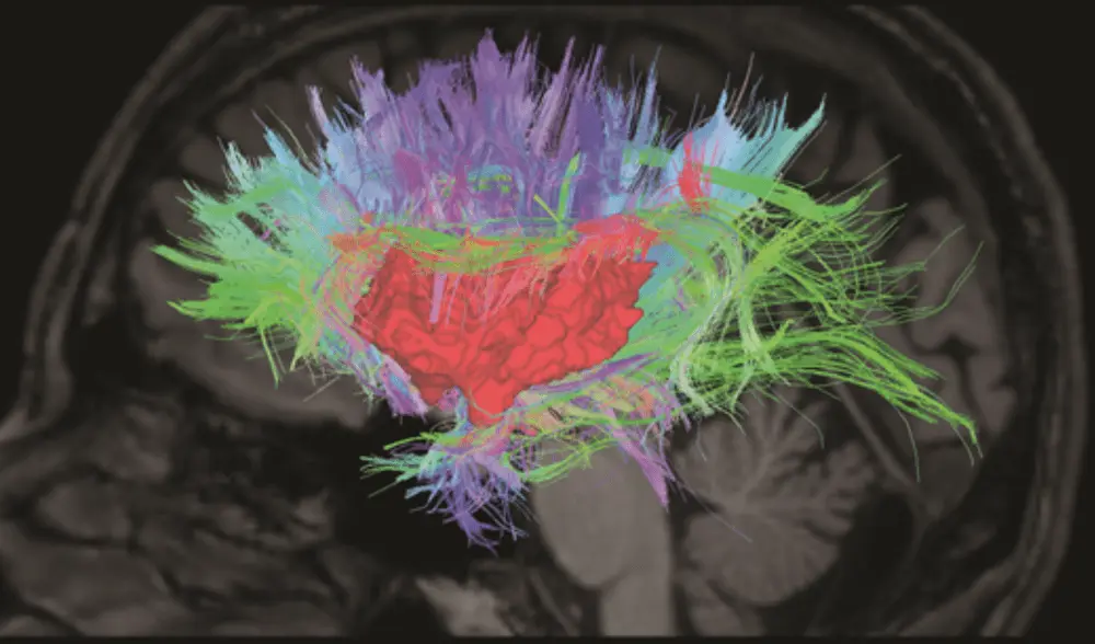 Insula